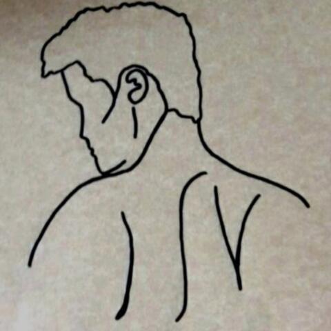 Scars