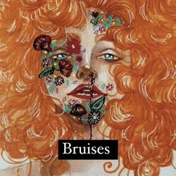 Bruises