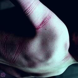 The Nachash — Plagued