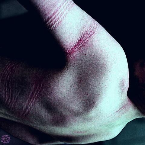 The Nachash — Plagued