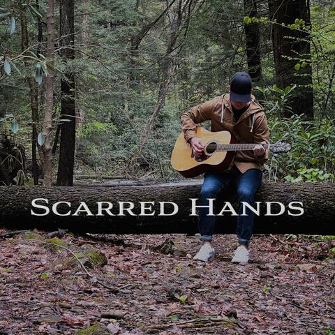 Scarred Hands