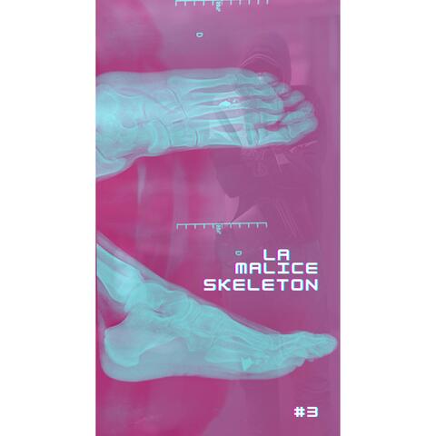 L'arrangé #3 (Skelton) (feat. TOLRACH)