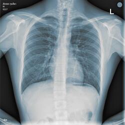 หายใจเป็นเธอ