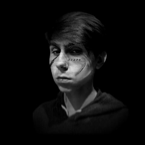 Scars