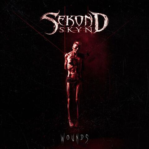 Wounds
