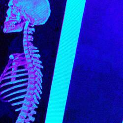 Smart and Spinal