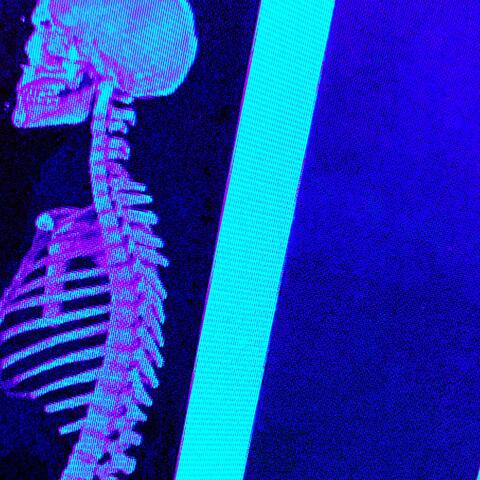 Smart and Spinal