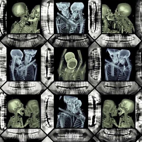 x-ray (feat. Ayo Tink)