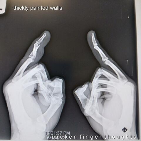 Broken Finger Thoughts