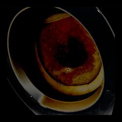 Kneecap