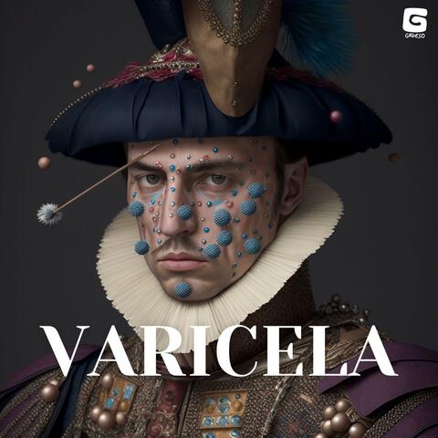 Varicela