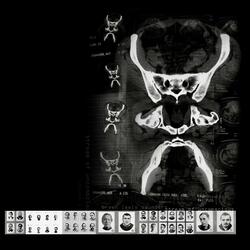 Red Bugs (feat. Kommissar Hjuler und Frau)