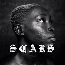 Scars (feat. BLMGSantana)
