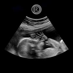 Съм (feat. Sashhh)