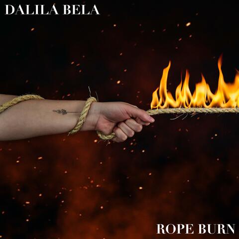 Rope Burn