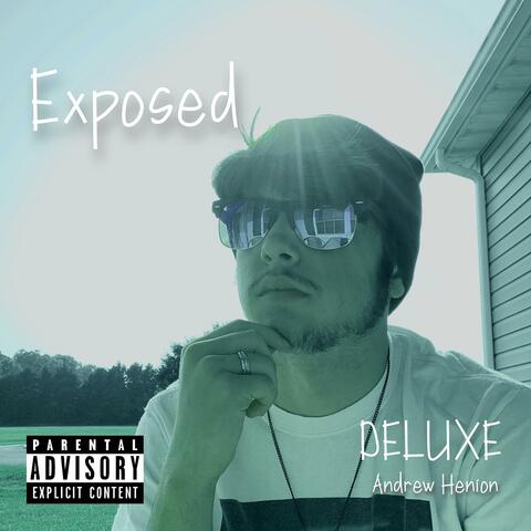 Exposed (Deluxe)