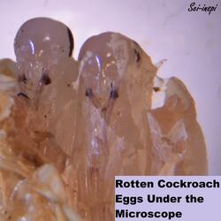 Rotten Cockroach Eggs Under the Microscope