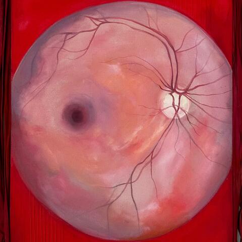 The Ideal Optic Nerve