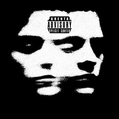 MIGRAINE