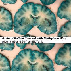 Brain of Patient Treated with Methylene Blue