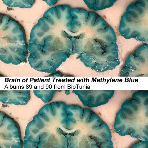 Brain of Patient Treated with Methylene Blue