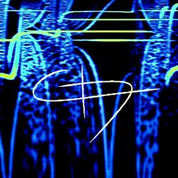 Running (feat. SLIM)