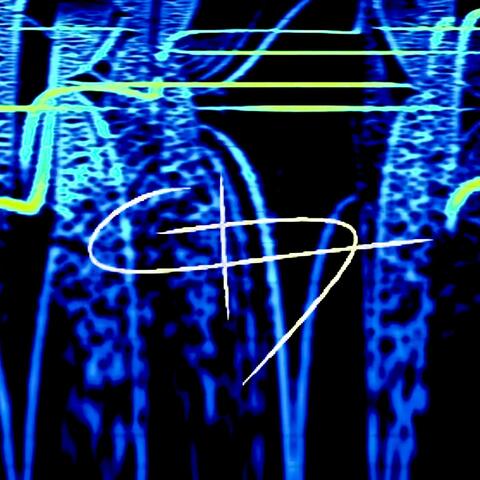 Running (feat. SLIM)