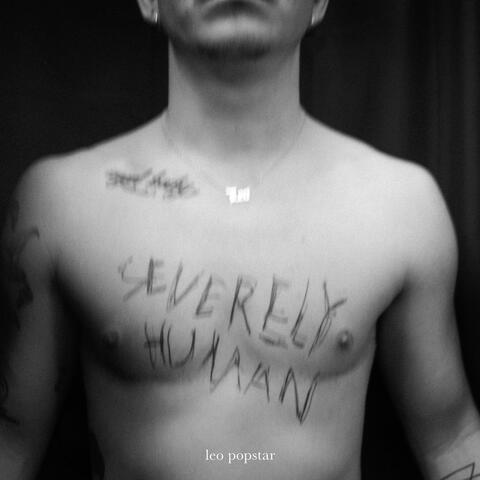 severely human