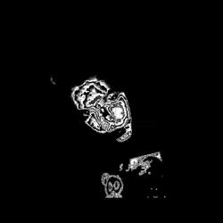 on sum other shi #visionscore