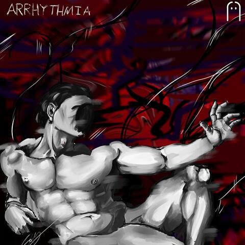 Arrhythmia
