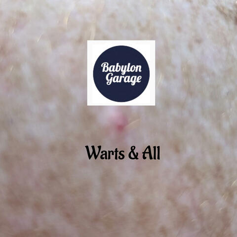 Warts n All