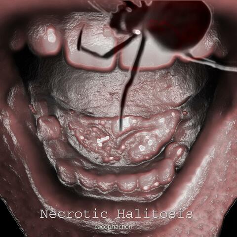 Necrotic Halitosis