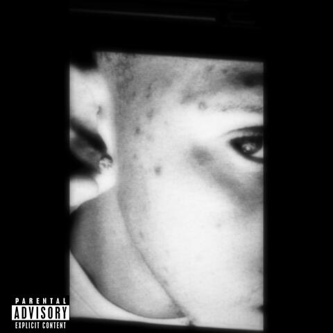 LOSTBOY