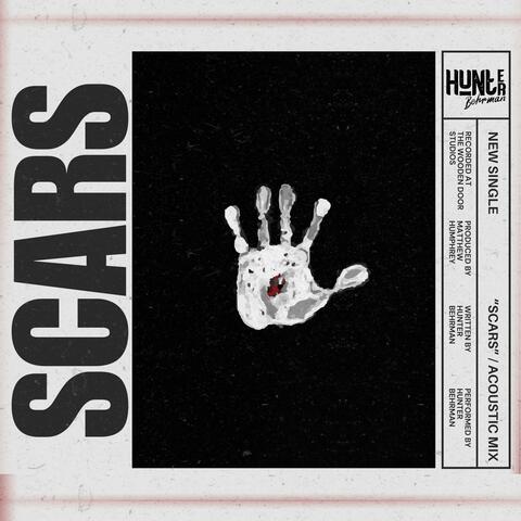 Scars