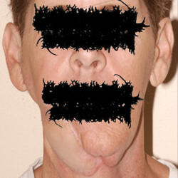 grotesque facial reconstruction