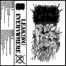 BACON DOINK // METALCORE IS FOR LOSERS (SIDE 1)