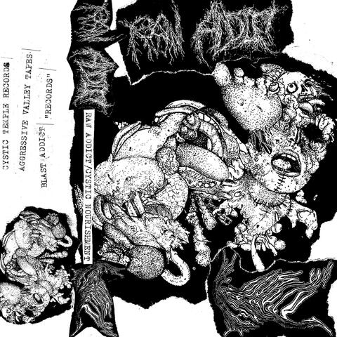 SPLIT WITH CYSTIC NOURISHMENT