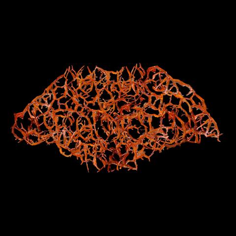 Rupture of the Gastrointestinal Tract