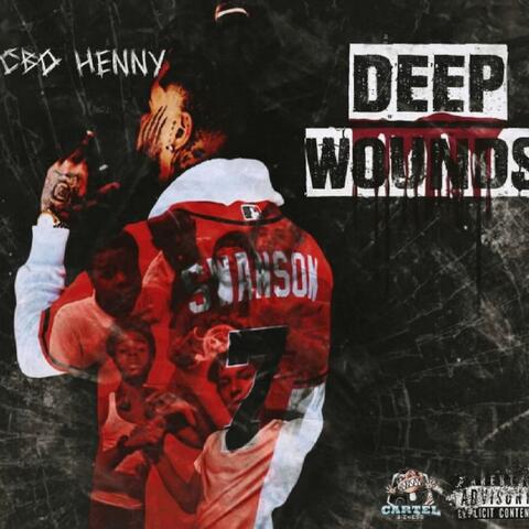 Deep Wounds