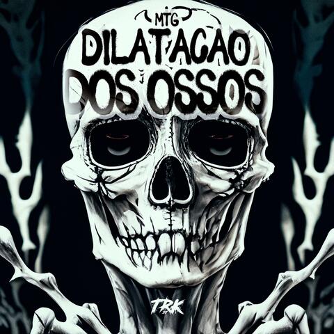 MTG - DILATAÇÃO DOS OSSOS