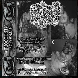 Fuck You White Supremacist's (ALBUM TEASER)