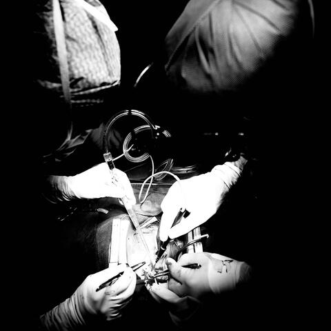 Surgery (feat. Grim Barx)