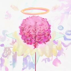 arrhythmia