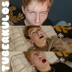 Tuberkulos