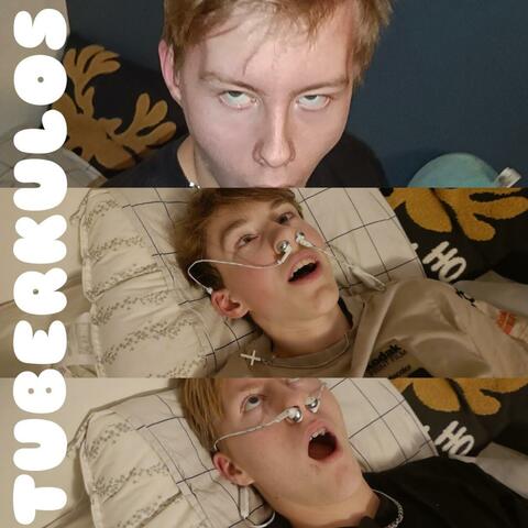 Tuberkulos (Single Version)