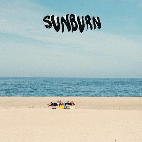 Sunburn