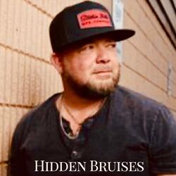 Hidden Bruises