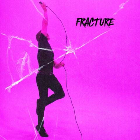 fracture