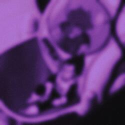 Standby (feat. Dj Crazy Eternal Sound) (Choppaholix Remix)