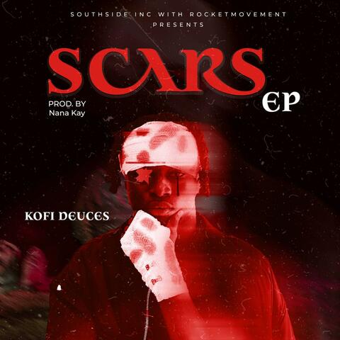 SCARS-EP